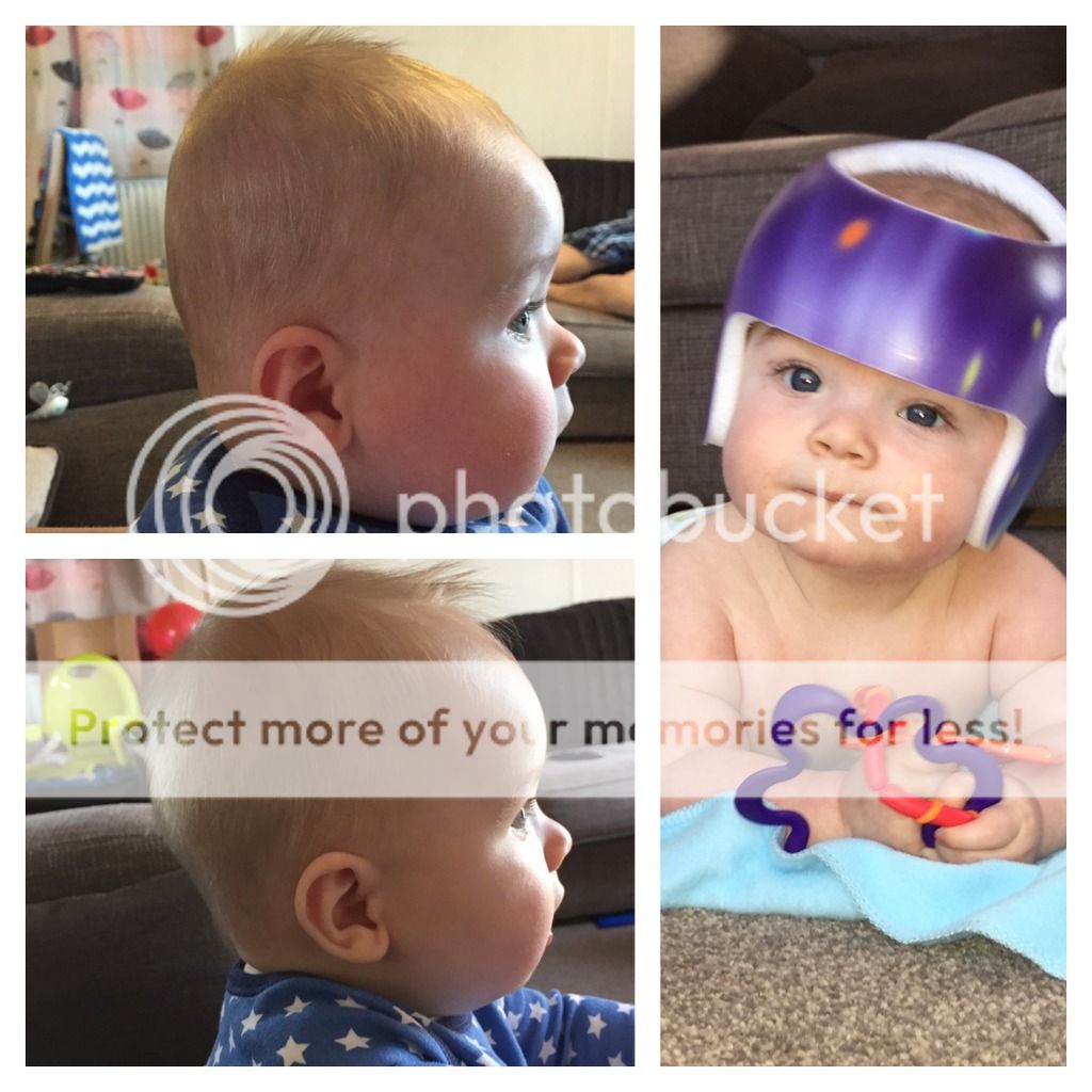 Helmet for flathead working (pic) BabyCentre